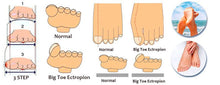 1 Pair Cushion Aid Silica Gel Toe Separator Stretchers Alignment Bunion Pain Relief