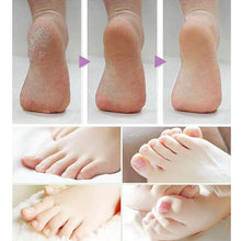 2017 1Pair Foot Care Tool Heads Pedi Hard Skin Remover Refills Replacement Rollers Perfect Fit