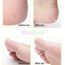 2017 1Pair Foot Care Tool Heads Pedi Hard Skin Remover Refills Replacement Rollers Perfect Fit