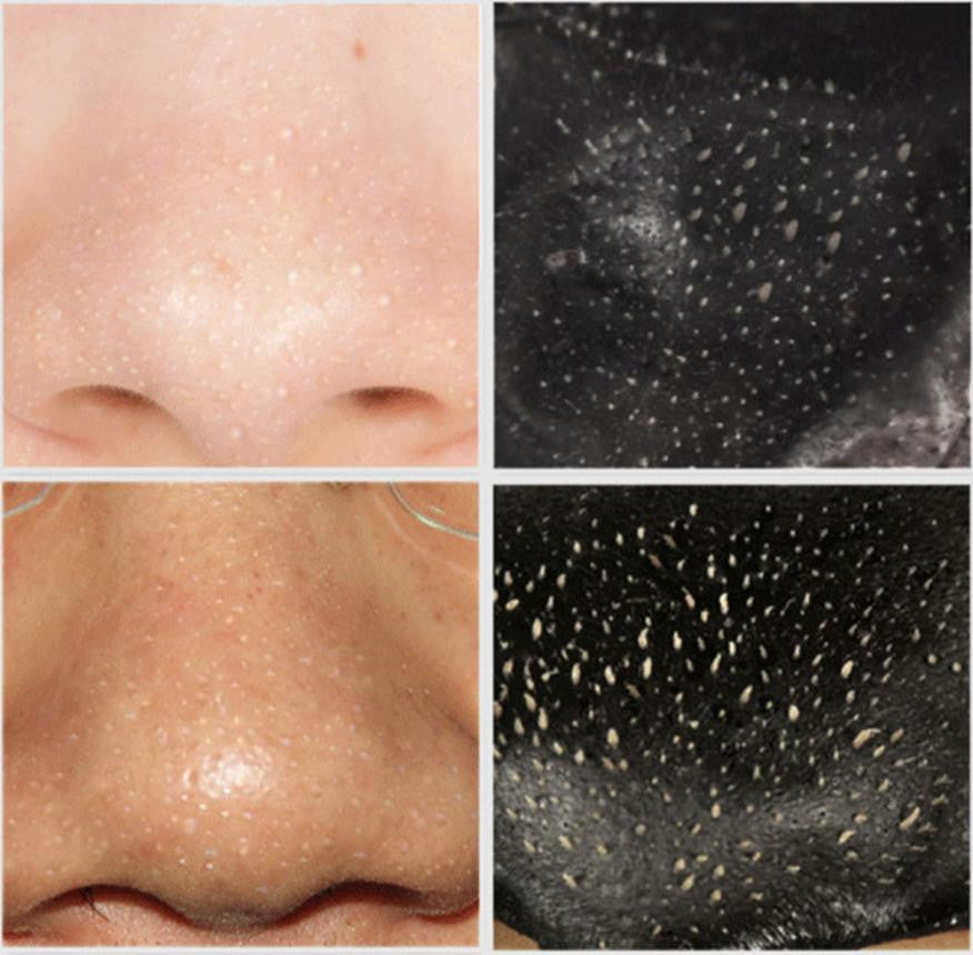 Hot Sale 10pcs Remove High Quality Mineral Mud Nose Blackhead Pore Cleansing Cleaner Removal Nose Membranes Strips 2017 Anne