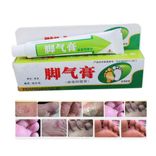 Snake Venom Protease Ointment Stubborn Psoriasis Dermatitis Chronic Eczema