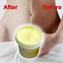 Thailand Skin Body Cream Remove Stretch Marks Treatment Postpartum Repair Whitening CREAM Pregnancy Scar Removal