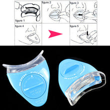 Whitening Teeth Dental Tooth Whitener Whitelight New